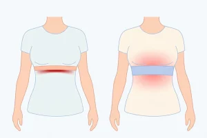 Illustration comparing a narrow bra band with strong pressure on ribs versus a wide band that spreads pressure for comfort.